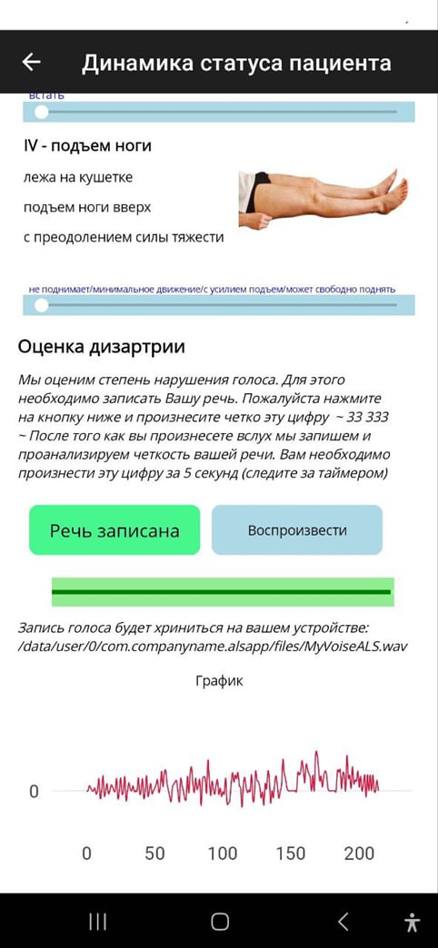 Динамика отслеживания голоса. Оценка дизартрии с применением методов искусственного интеллекта.